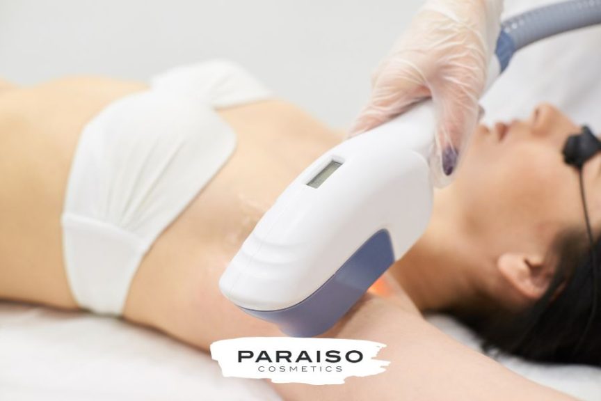 Cuidados que necesita la piel tras la depilación en verano